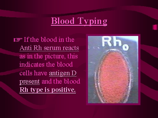 Blood Typing