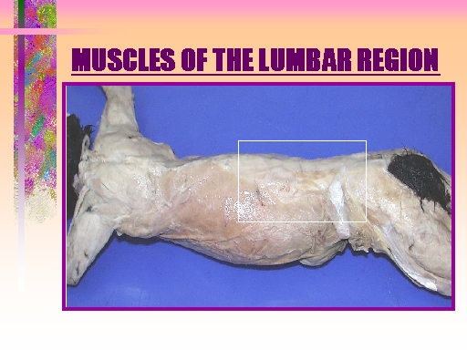 MUSCLES OF THE LUMBAR REGION